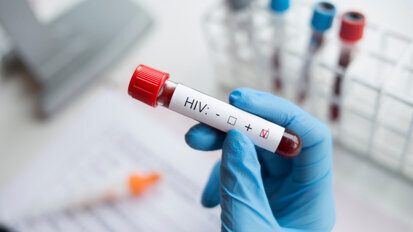 People living with HIV struggle to access oral health services