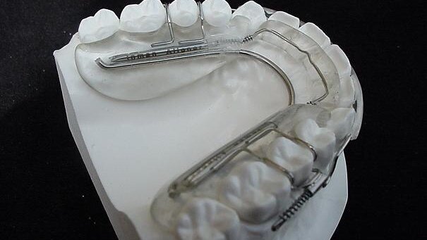 Ethical smile design with the Inman Aligner―A case study