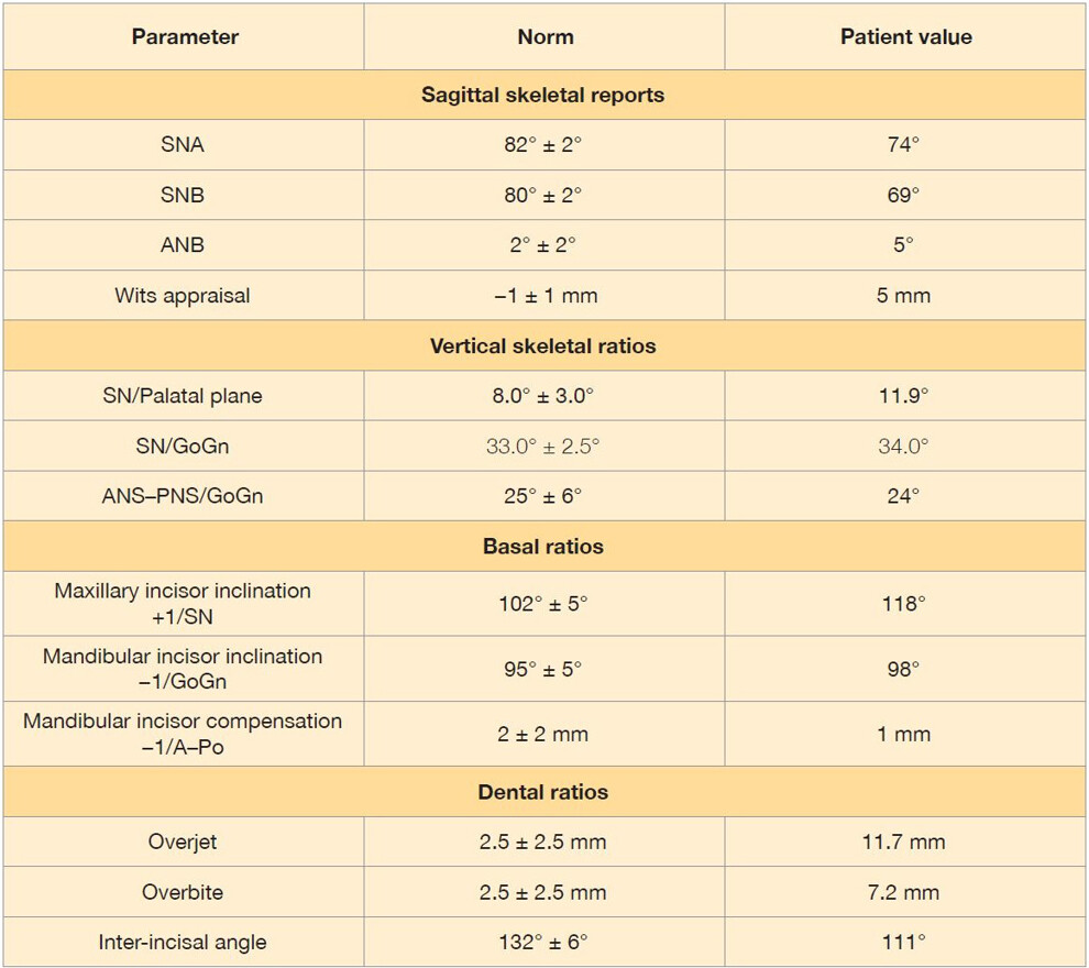 Table 1: Initial cephalometric analysis showing sagittal, vertical, basal and dental measurements compared with reference norms.