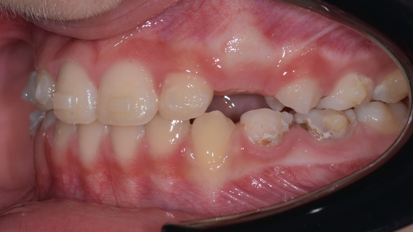 Fig. 2f