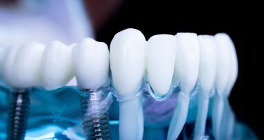Bones and machines: AI and the transformation of dental implantology