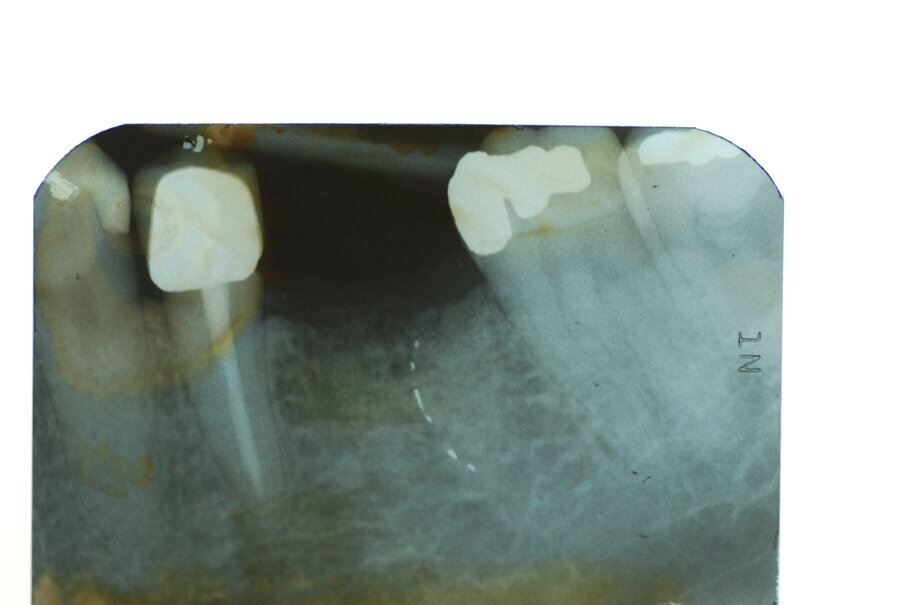Fig. 10
