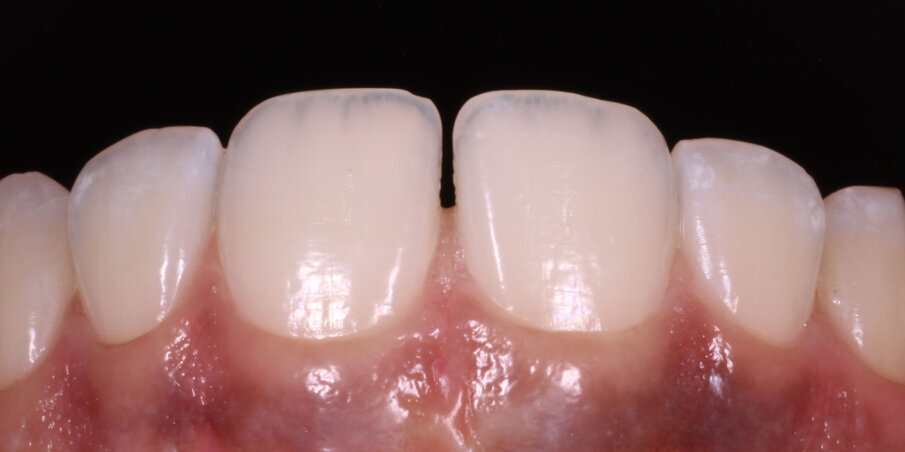 Fig 2. Pre-op