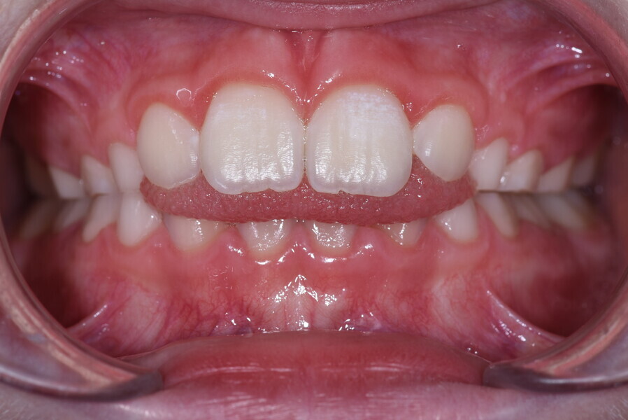Fig. 1b
