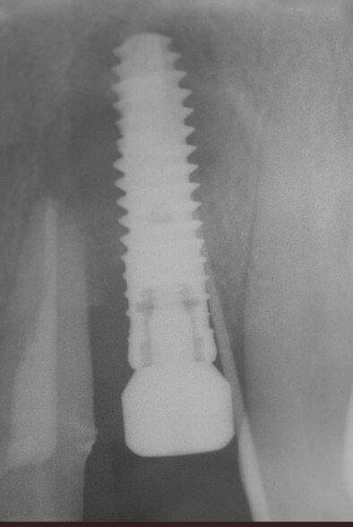 Fig. 18