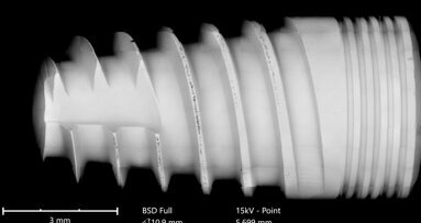 How clean do sterile implants have to be? Analysis and clinical relevance of factory-related contaminations