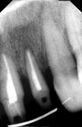 Fig. 12