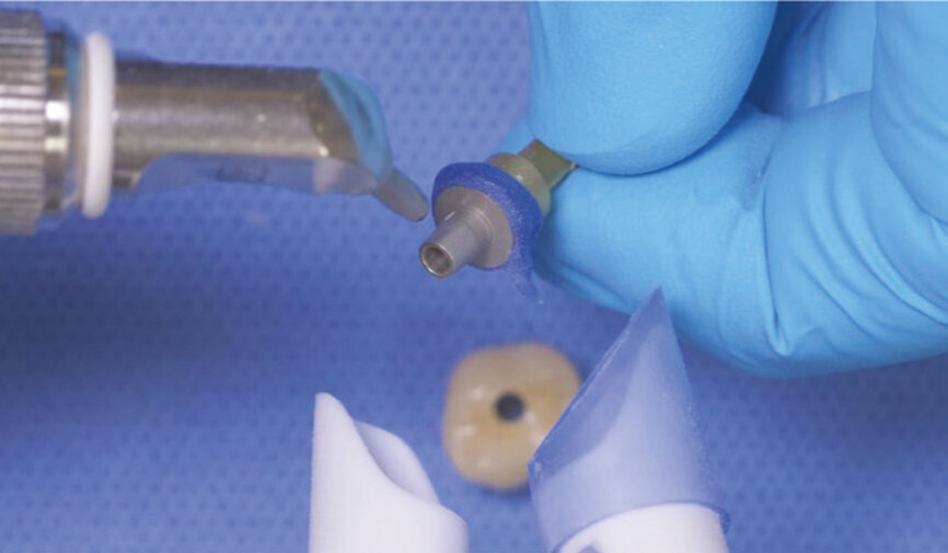 Fig. 3: Air abrade the abutment with 30–50 μm alumina powder at 220.6 kPa. 