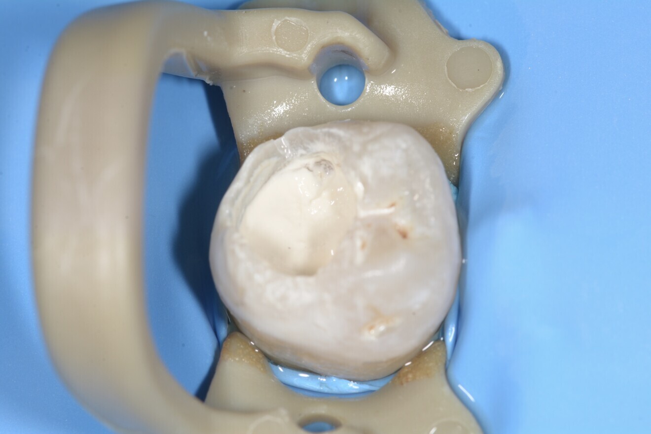 Fig. 13 : Temps de prise initial.