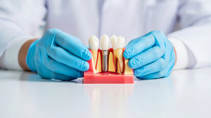 Dentsply Sirona announces new webinars on implant dentistry