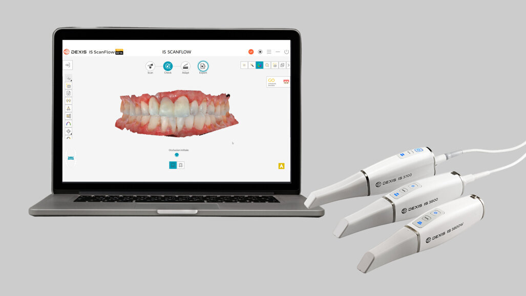 DEXIS IOS Solutions élargit son écosystème en proposant de nouveaux flux de travail numériques complets