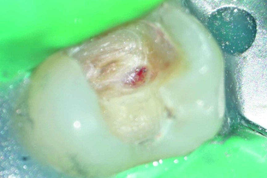 Fig. 12