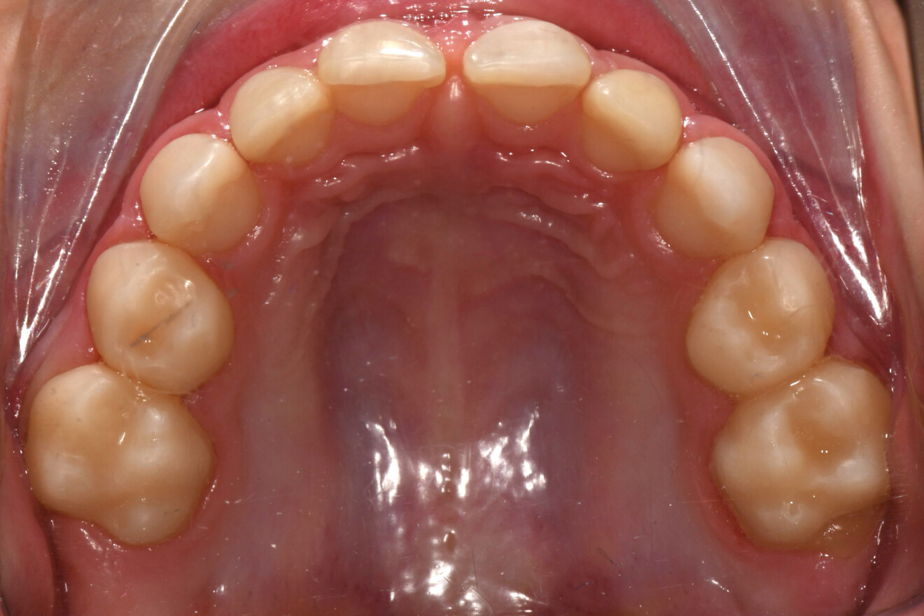Fig. 8e