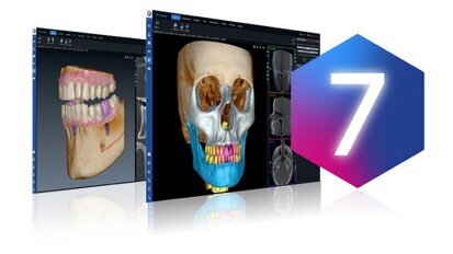 Planmeca launches Romexis 7 with advanced AI tools