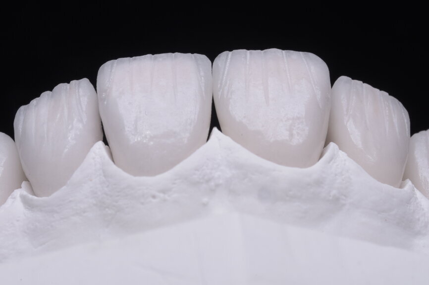 Fig. 71: Restoration units
after staining.