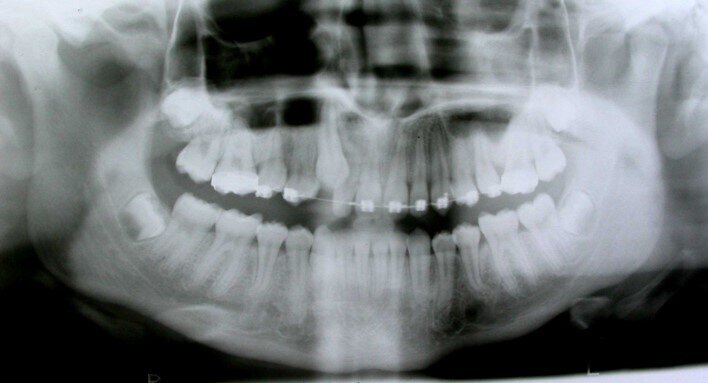 Fig. 10