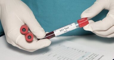 Продукти от пародонтопатогени могат да активират латентен HIV