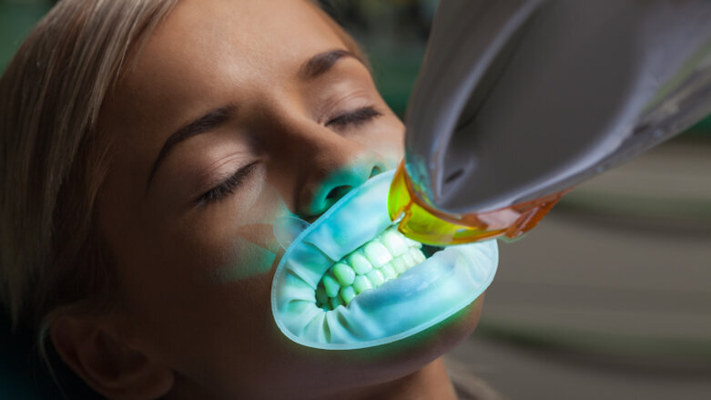 Interview: “It is often not possible to achieve perfectly white teeth”