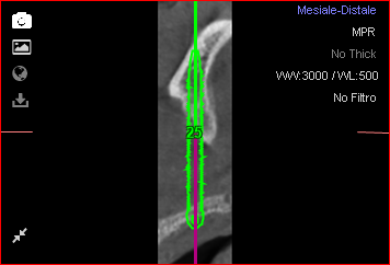Fig. 25b
