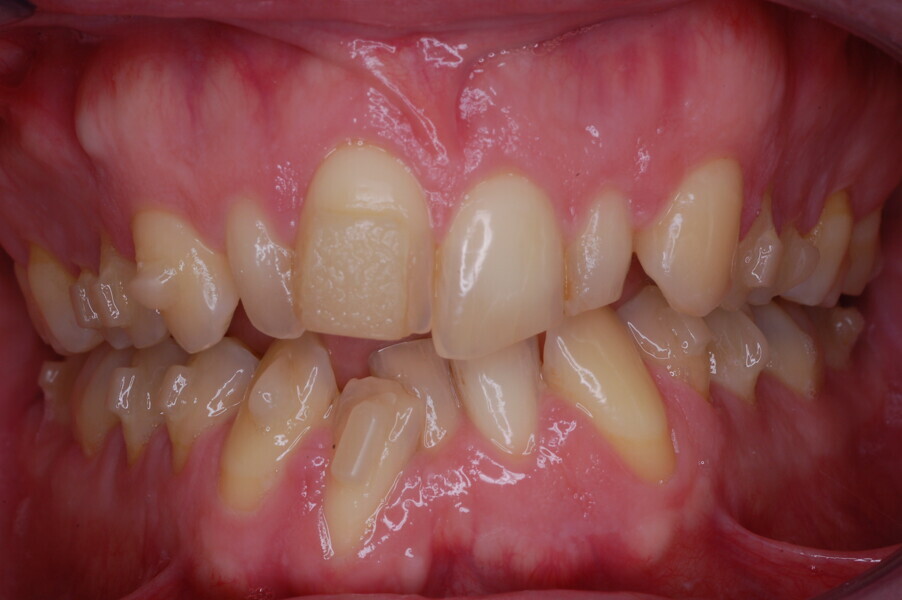 Fig. 46.