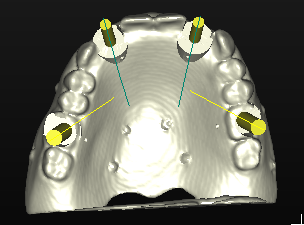Fig. 18