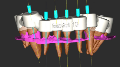 Research team receive multiple awards for micro-guided endodontics technique