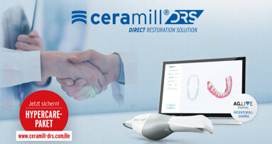 Ceramill DRS: Exklusive Vorteile für Anwender der ersten Stunde