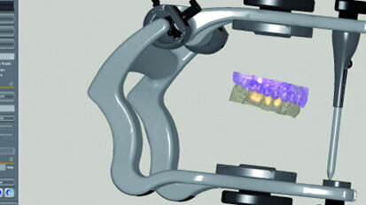 Zirkonzahn lança novo módulo CAD/CAM Articulador Virtual
