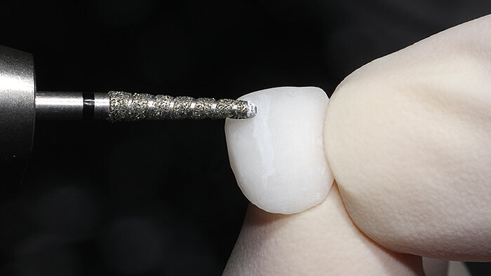 Fig. 10: The incorporation of texture and morphology with the rotating diamond tool.