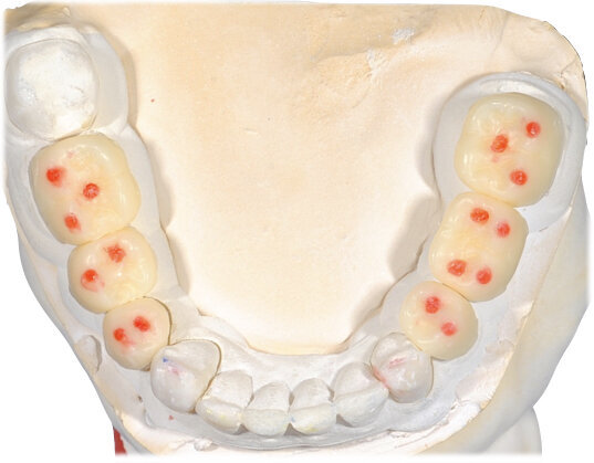 Fig. 35
