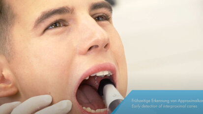 Dürr Dental – VistaCam iX HD Smart