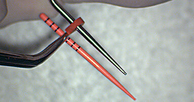 The continuous wave of obturation technique for enhanced precision