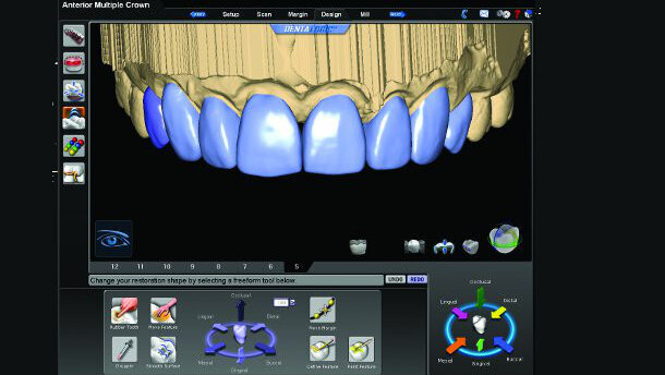 CAD/CAM dentistry and the laboratory technician: Partners in success