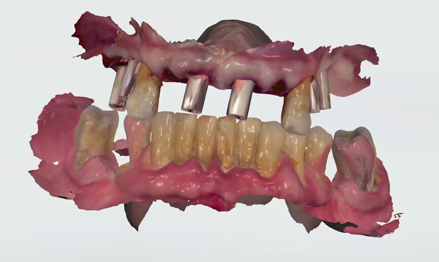 Fig. 11