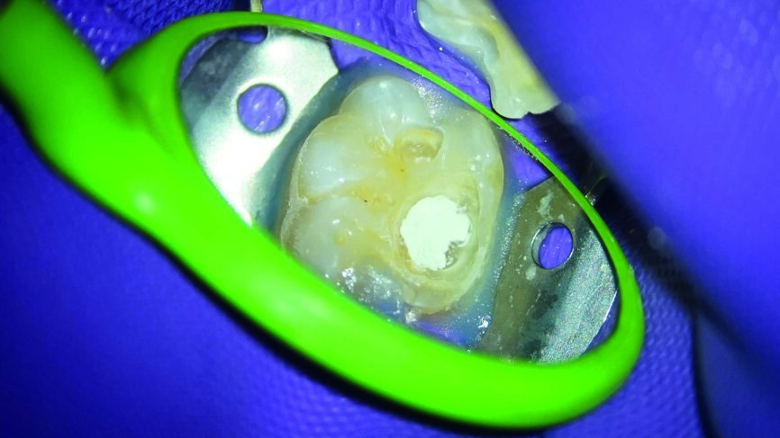 Fig. 6