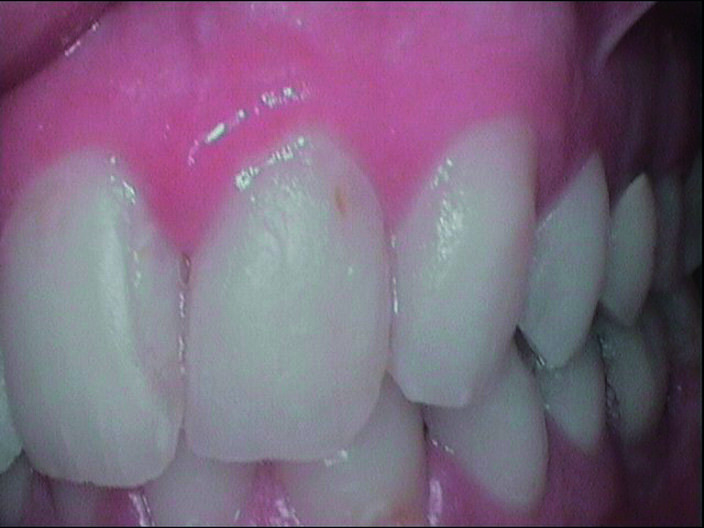 Fig. 2d