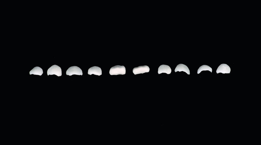 Fig. 19: Ready veneers before cementation.