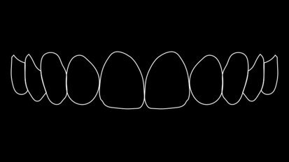 Figura 3. Simulación numérica de la sonrisa ideal.