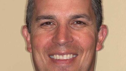 Basic instincts and the dental metamorphosis