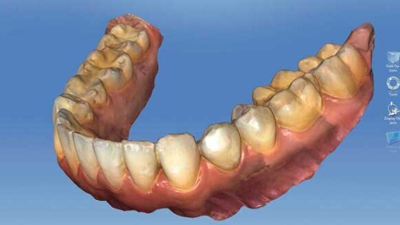 Sirona unveils products designed to enhance orthodontic practice productivity