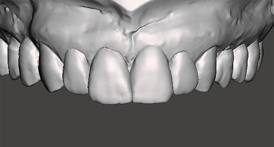 Fig. 10h