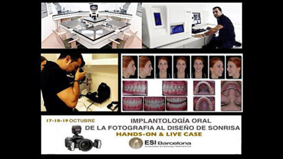 Curso de fotografía digital - diseño de la sonrisa