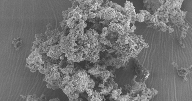 Empastes del futuro con rellenos vítreos bioactivos