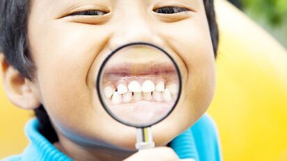 Cerca de um sexto das crianças em Xangai sofrem de erosão dentária