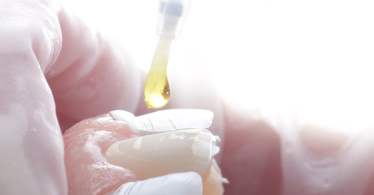Tips and tricks for bonding in minimally invasive repair pro