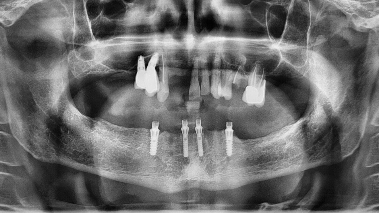 Fig. 6.