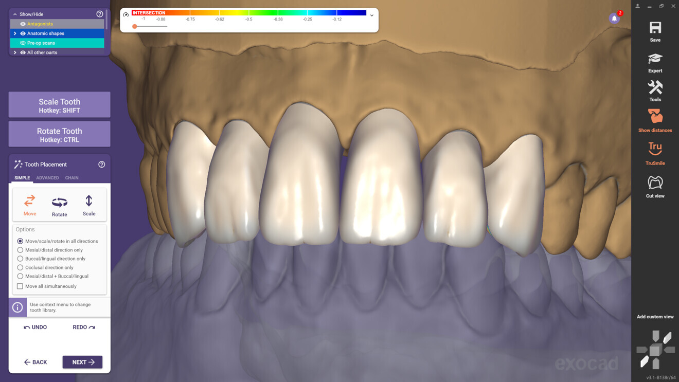 DentalCAD.
