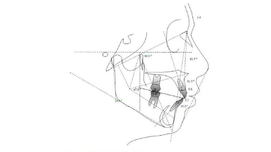 Fig. 5_Analisi cefalometrica.
