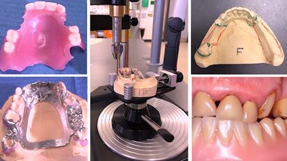 Edición Especial sobre Odontogeriatría