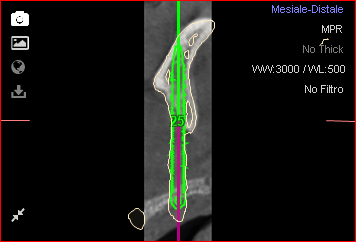 Fig. 25a